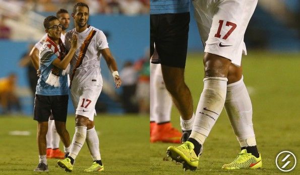 Benatia scarpe Magista Opus gialle