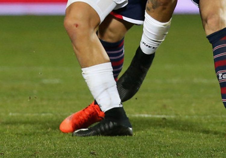 le scarpe di dybala